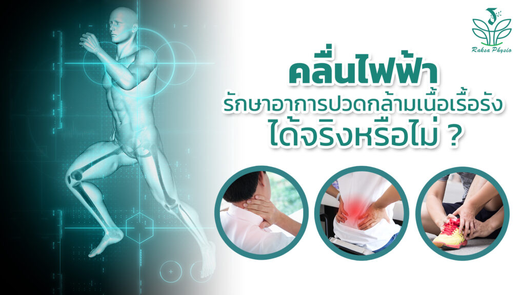 คลื่นไฟฟ้า รักษาอาการปวดกล้ามเนื้อเรื้อรัง