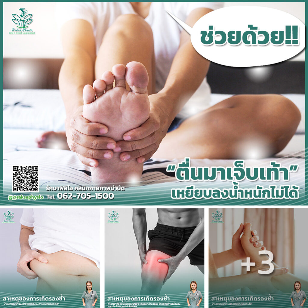 ตื่นมาเจ็บเท้า เหยียบลงน้ำหนักไม่ได้